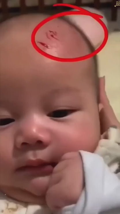 Baby Nail Clippers ™